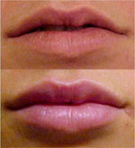 wype�nianie zmarszczek